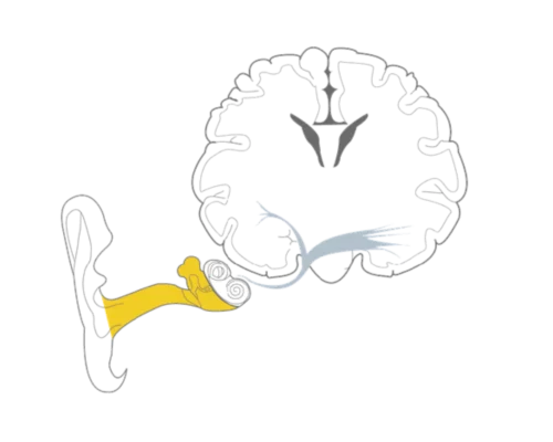 conductive-hearing-loss-1000-1000